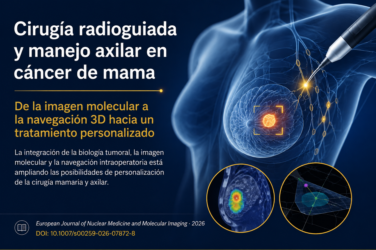 Cirugía radioguiada y navegación 3D en cáncer de mama